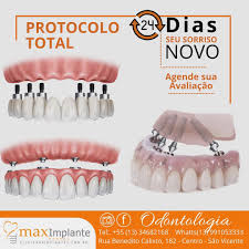 Foto de MAXIMPLANTE ODONTOLOGIA