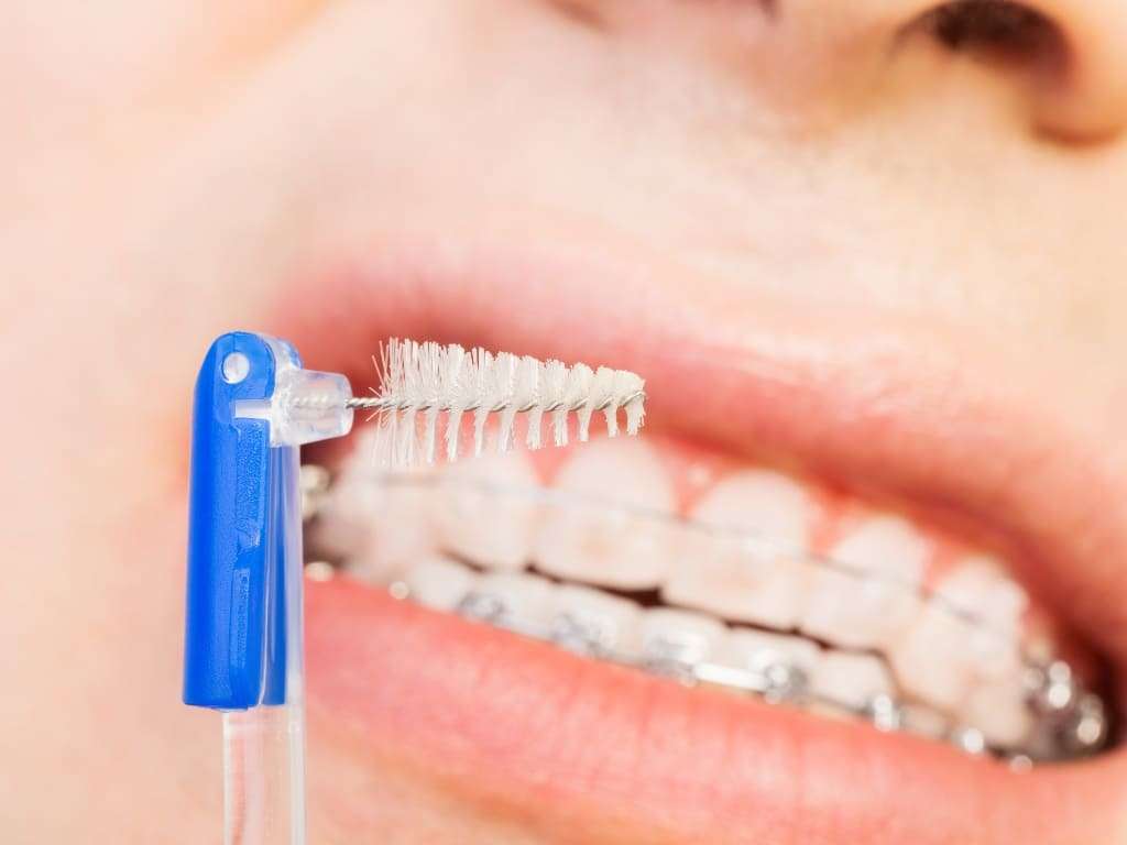 acessórios para higiene bucal encontre um dentista